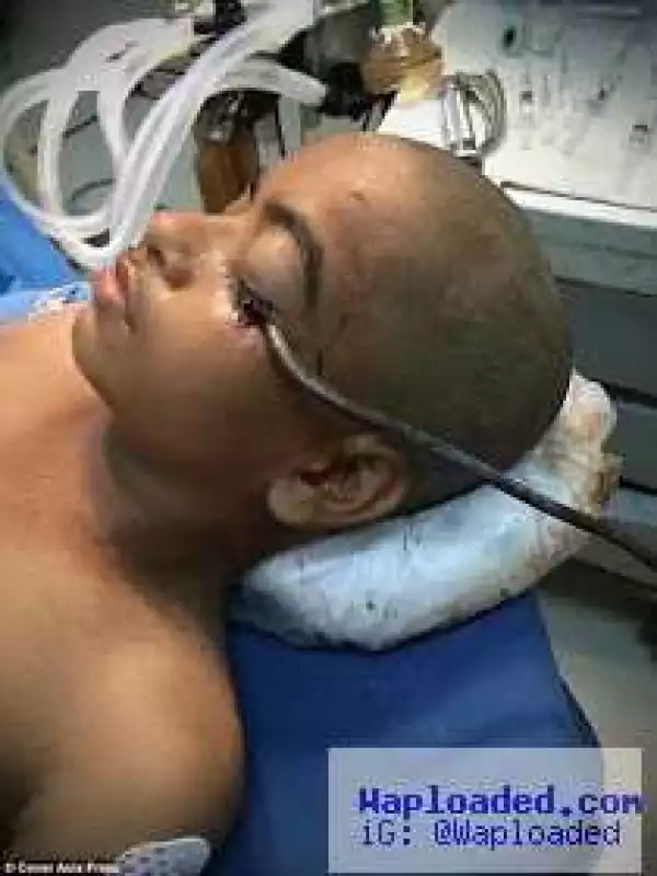 12-year-old boy with butcher meat hook plunged in his eye is incredibly saved by doctors (pics)